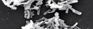 , from The Microbiome Project, Knightlab, UCSD, https://knightlab.ucsd.edu/wordpress/?p=116